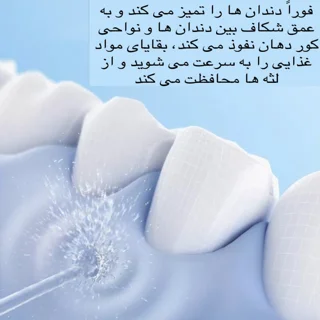 دستگاه شست و شوی دهان و دندان مدل 6886-Oral Irrigator 101523288