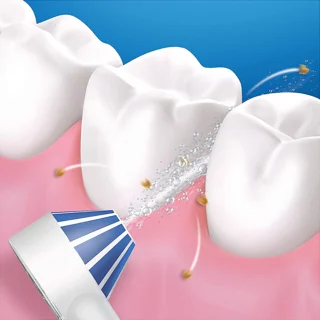 دستگاه واتر جت شست و شوی دهان و دندان اورال-بی مدل Aquacare4 101523264