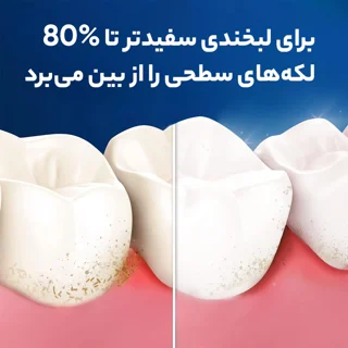 مسواک اورال-بی مدل 3D White با برس متوسط 101539642
